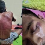 Foto: Seorang pengepul pisang bernama Puji Friayadi menjadi korban dugaan kekerasan yang dilakukan aparat Brimob Kukar. Sumber: Istimewa. Foto: Seorang pengepul pisang bernama Puji Friayadi menjadi korban dugaan kekerasan yang dilakukan aparat Brimob Kukar. Sumber: Istimewa.