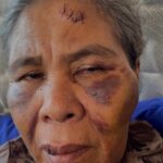 Foto: Suadah korban kekerasan. Sumber: Istimewa. Foto: Suadah korban kekerasan. Sumber: Istimewa.