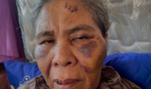 Foto: Suadah korban kekerasan. Sumber: Istimewa.