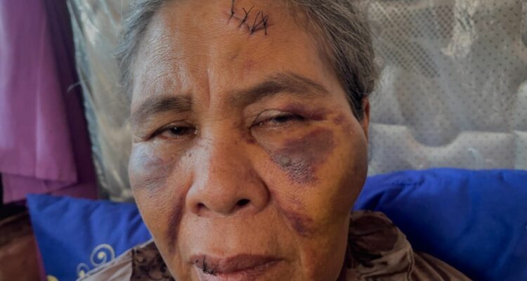 Foto: Suadah korban kekerasan. Sumber: Istimewa.