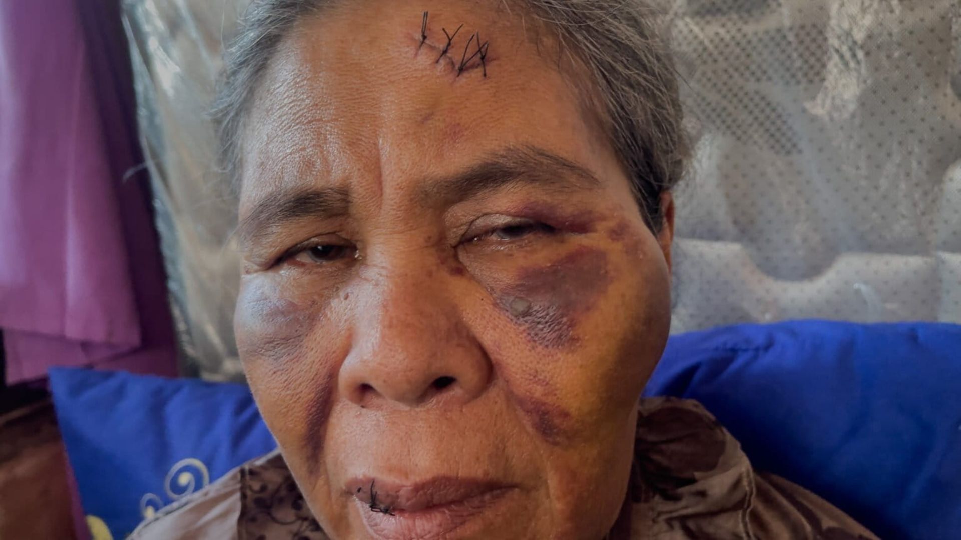 Foto: Suadah korban kekerasan. Sumber: Istimewa.